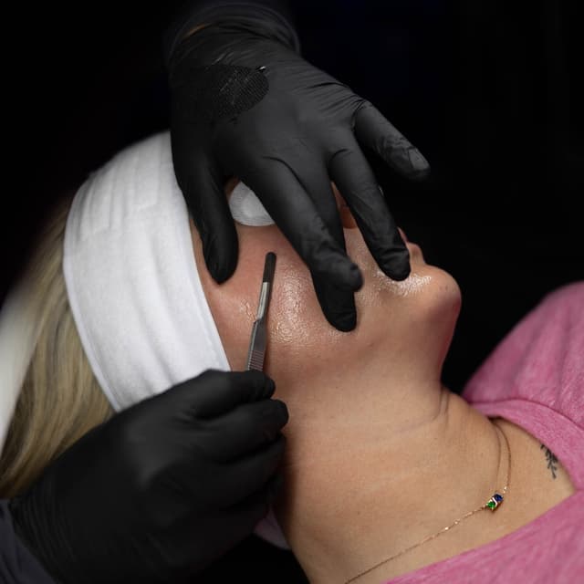 Deluxe Dermaplane at Aglow by LA Esthetics Ashley Rutter in Glenpool, OK