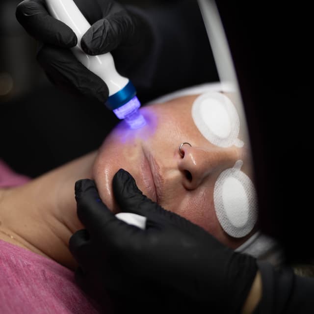 Hydrofacial + Dermaplane at Aglow by LA Esthetics Ashley Rutter in Glenpool, OK